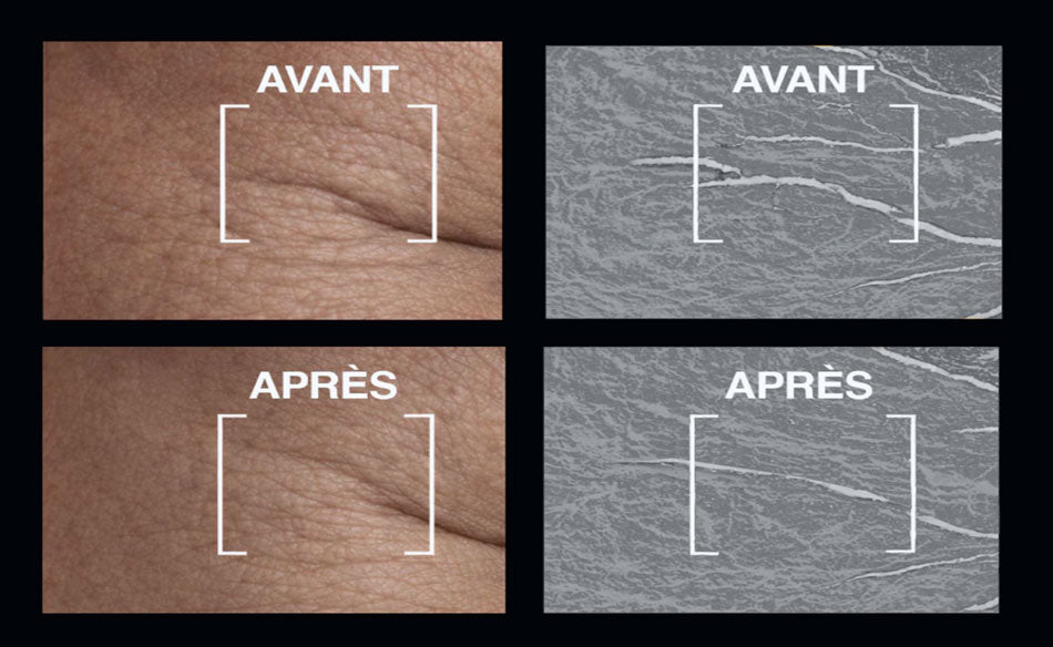 Résultat avant après soin de nuit