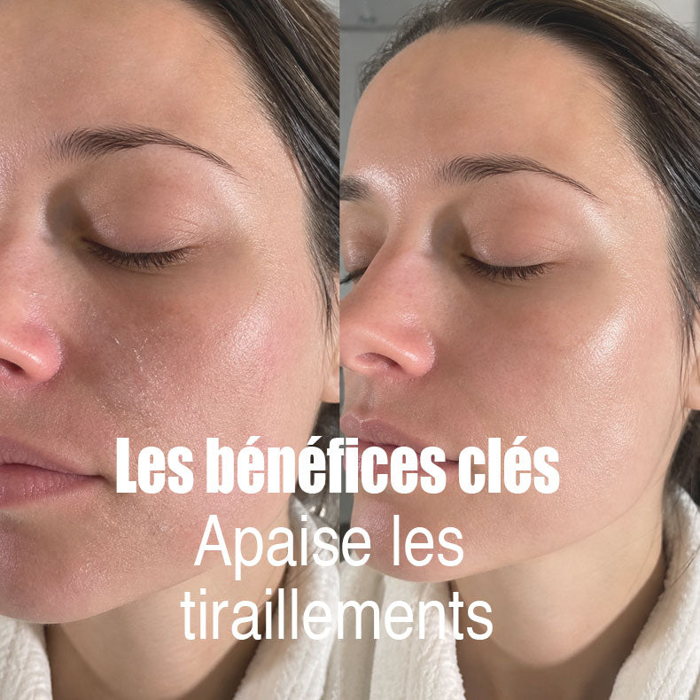 Protection naturelle